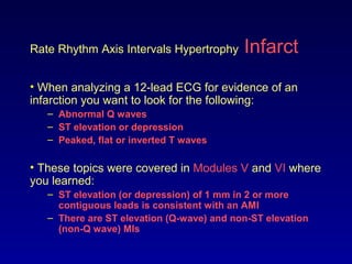 Rate Rhythm Axis Intervals Hypertrophy Infarct
• When analyzing a 12-lead ECG for evidence of an
infarction you want to look for the following:
– Abnormal Q waves
– ST elevation or depression
– Peaked, flat or inverted T waves
• These topics were covered in Modules V and VI where
you learned:
– ST elevation (or depression) of 1 mm in 2 or more
contiguous leads is consistent with an AMI
– There are ST elevation (Q-wave) and non-ST elevation
(non-Q wave) MIs
 