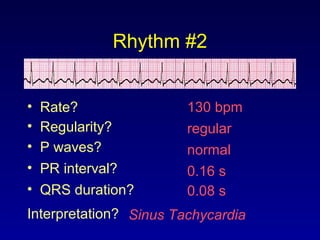 Rhythm #2
130 bpm• Rate?
• Regularity? regular
normal
0.08 s
• P waves?
• PR interval? 0.16 s
• QRS duration?
Interpretation? Sinus Tachycardia
 