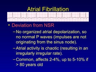 Atrial Fibrillation
• Deviation from NSR
–No organized atrial depolarization, so
no normal P waves (impulses are not
originating from the sinus node).
–Atrial activity is chaotic (resulting in an
irregularly irregular rate).
–Common, affects 2-4%, up to 5-10% if
> 80 years old
 
