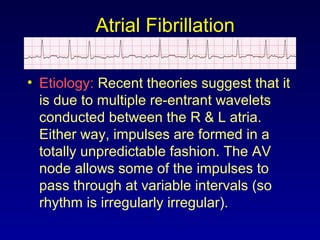 Atrial Fibrillation
• Etiology: Recent theories suggest that it
is due to multiple re-entrant wavelets
conducted between the R & L atria.
Either way, impulses are formed in a
totally unpredictable fashion. The AV
node allows some of the impulses to
pass through at variable intervals (so
rhythm is irregularly irregular).
 