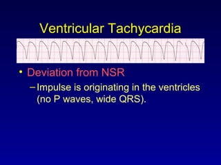 Ventricular Tachycardia
• Deviation from NSR
–Impulse is originating in the ventricles
(no P waves, wide QRS).
 