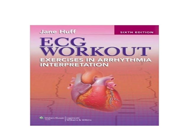 6 Day Ecg Workout Exercises In Arrhythmia Interpretation 7Th Edition for Weight Loss