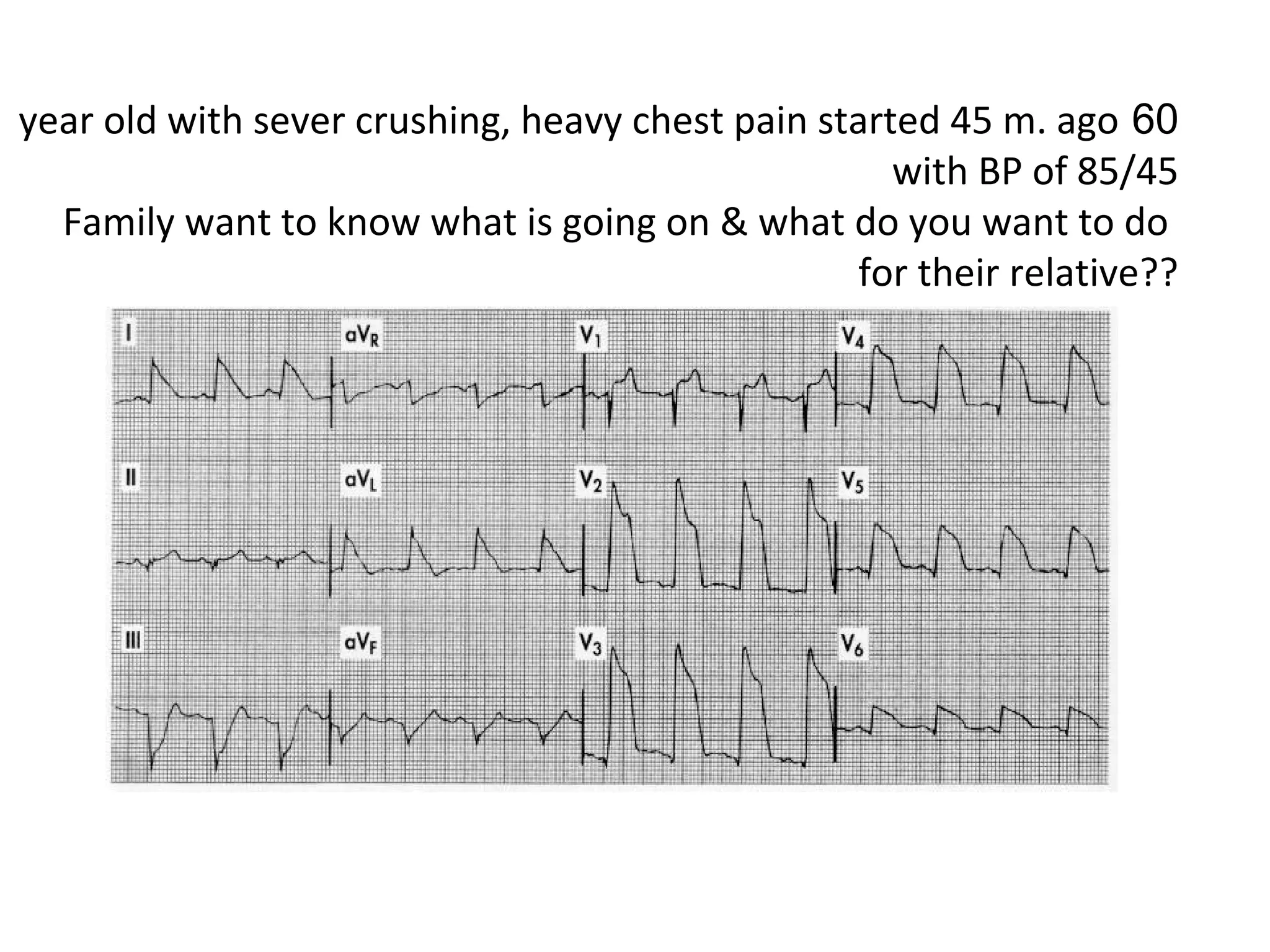 year old with sever crushing, heavy chest pain started 45 m. ago 60
with BP of 85/45
Family want to know what is going on & what do you want to do
for their relative??

 