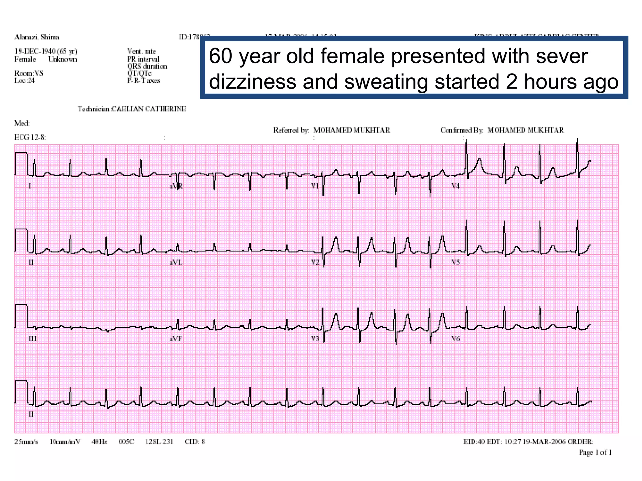60 year old female presented with sever
dizziness and sweating started 2 hours ago

 