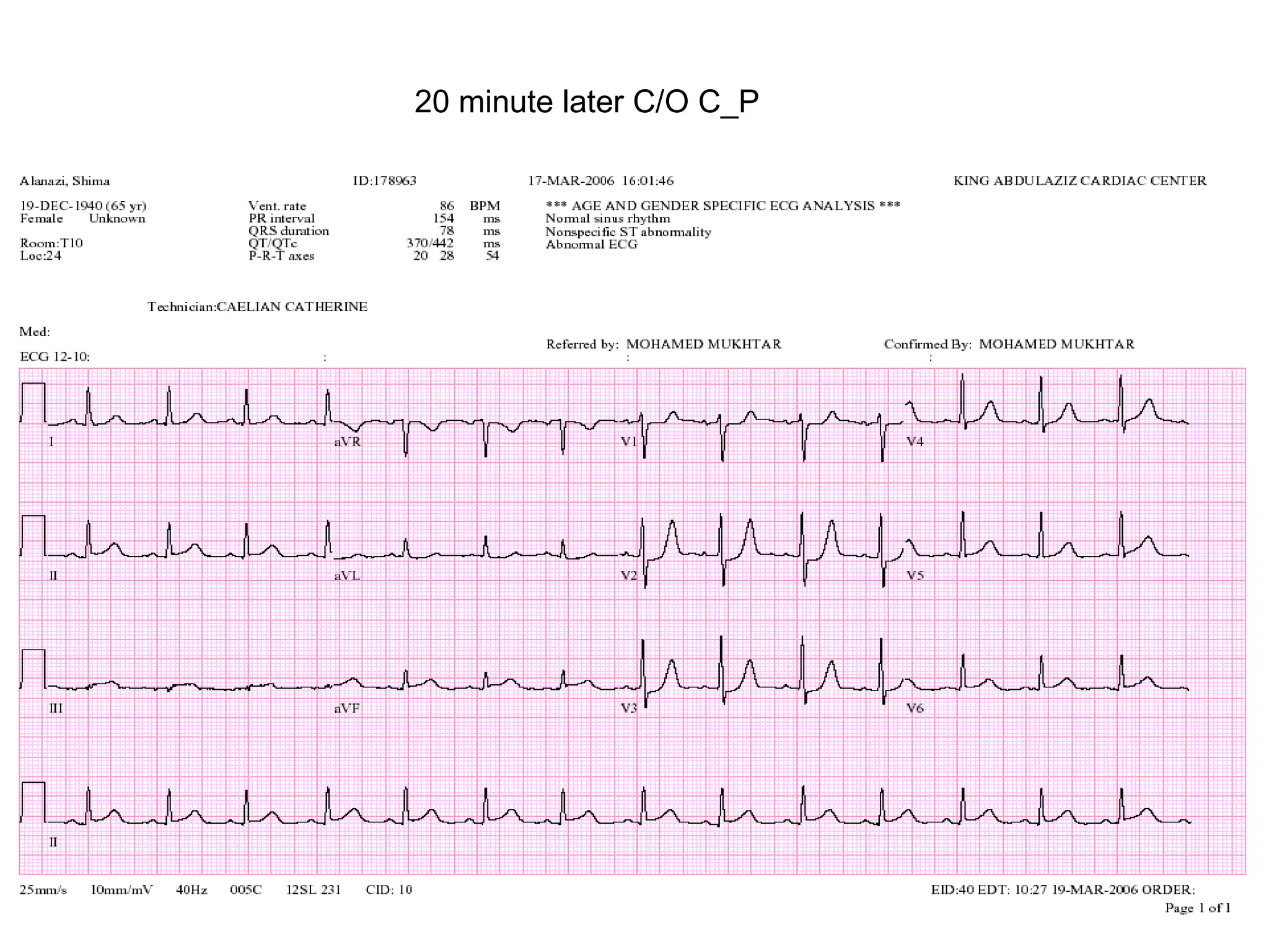 20 minute later C/O C_P

 