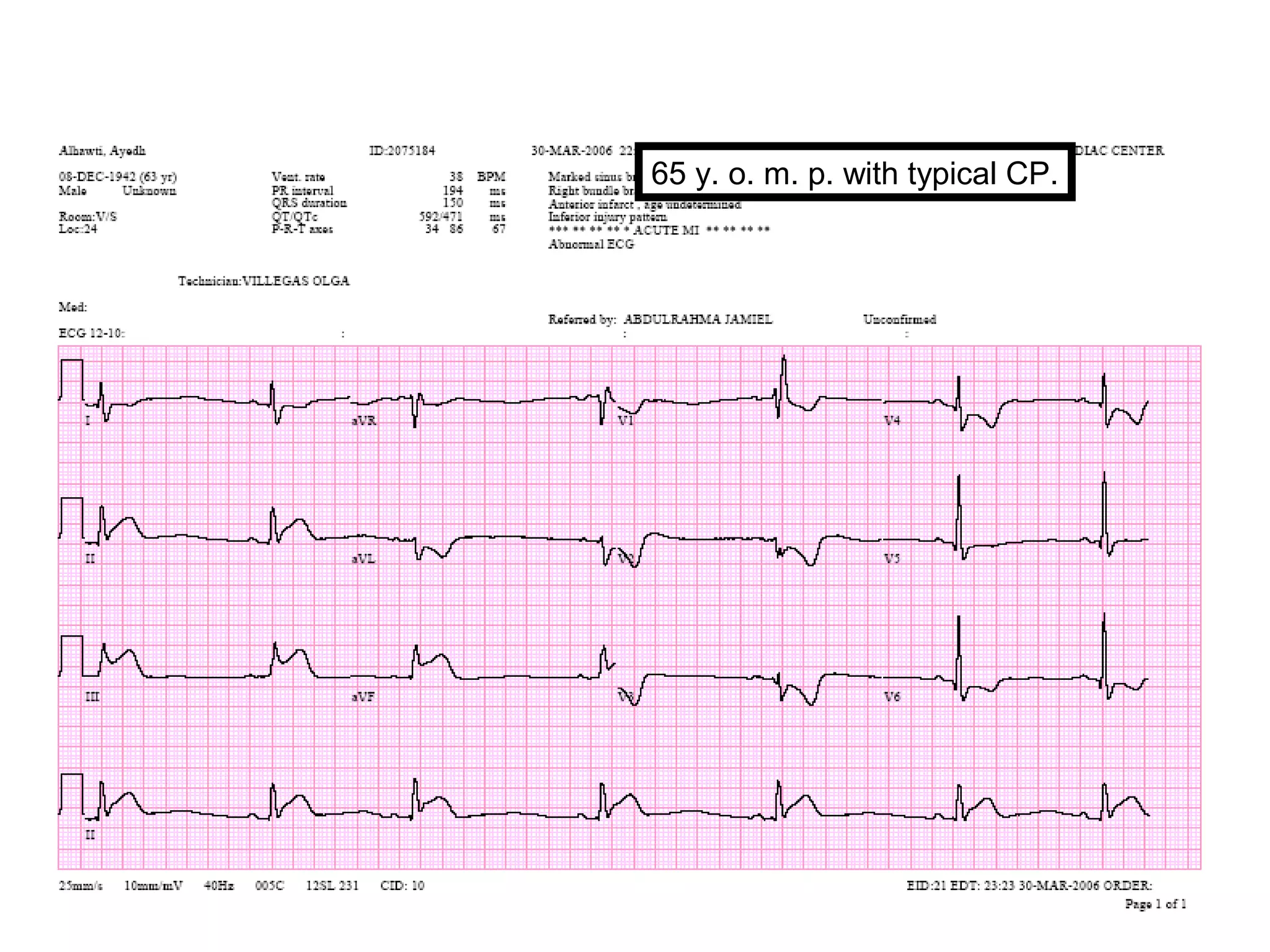 65 y. o. m. p. with typical CP.

 