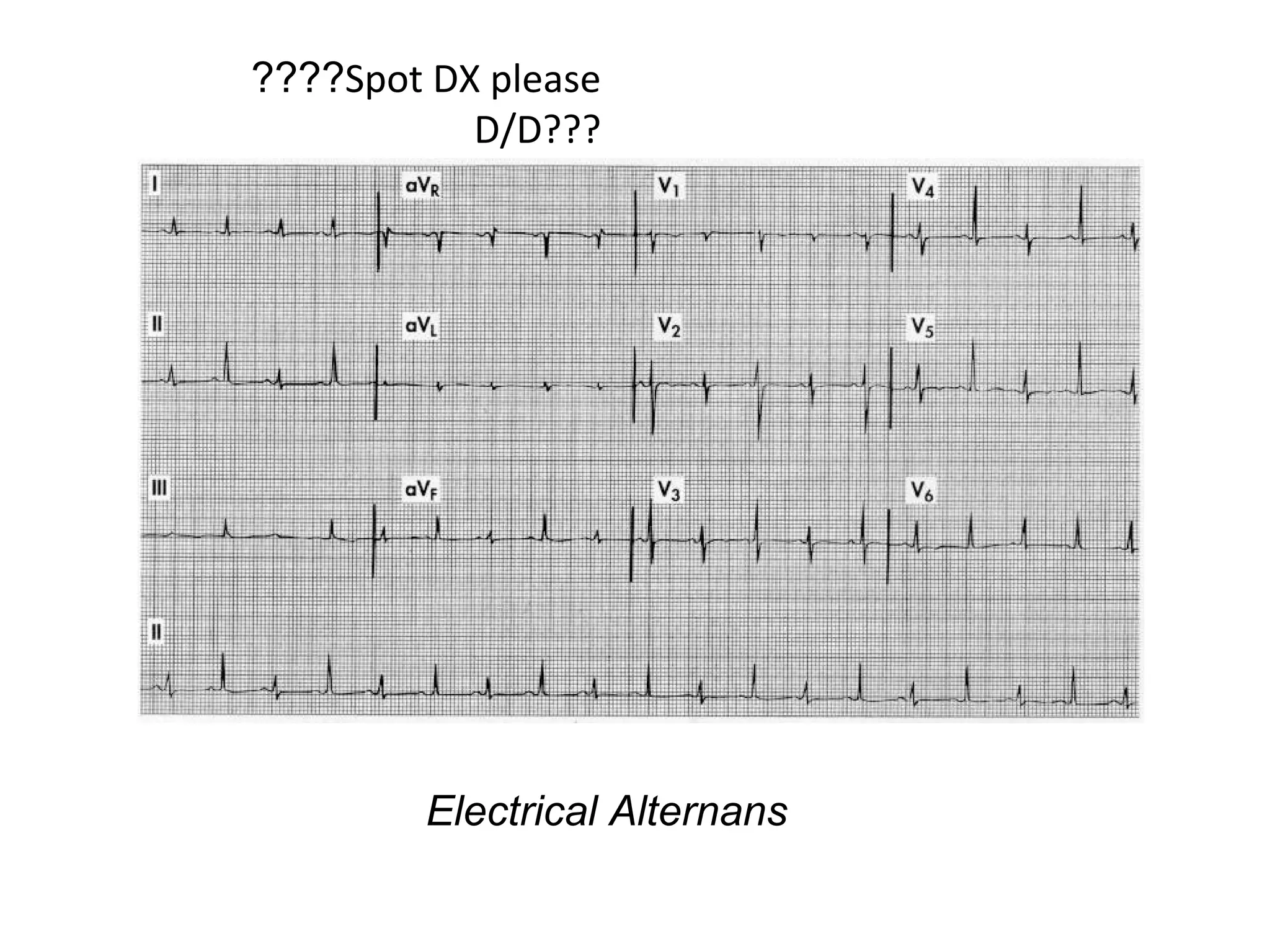 ????Spot DX please
D/D???

Electrical Alternans

 
