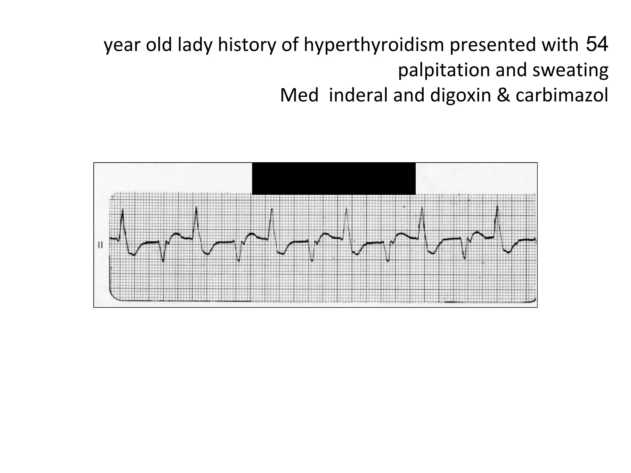 year old lady history of hyperthyroidism presented with 54
palpitation and sweating
Med inderal and digoxin & carbimazol

 