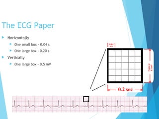 Ecg workshop | PPT