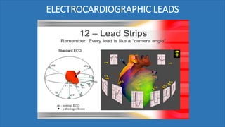 ELECTROCARDIOGRAPHIC LEADS
 