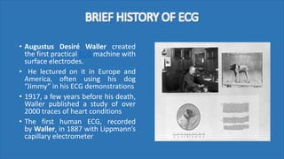 BRIEF HISTORY OF ECG
• Augustus Desiré Waller created
the first practical ECG machine with
surface electrodes.
• He lectured on it in Europe and
America, often using his dog
“Jimmy” in his ECG demonstrations
• 1917, a few years before his death,
Waller published a study of over
2000 traces of heart conditions
• The first human ECG, recorded
by Waller, in 1887 with Lippmann’s
capillary electrometer
 
