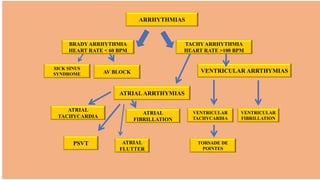 ARRHYTHMIAS
BRADY ARRHYTHMIA
HEART RATE < 60 BPM
TACHY ARRHYTHMIA
HEART RATE >100 BPM
VENTRICULAR ARRTHYMIAS
ATRIALARRTHYMIAS
SICK SINUS
SYNDROME AV BLOCK
ATRIAL
TACHYCARDIA
ATRIAL
FIBRILLATION
PSVT ATRIAL
FLUTTER
VENTRICULAR
FIBRILLATION
VENTRICULAR
TACHYCARDIA
TORSADE DE
POINTES
 