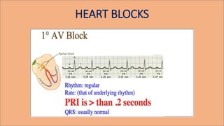 HEART BLOCKS
 