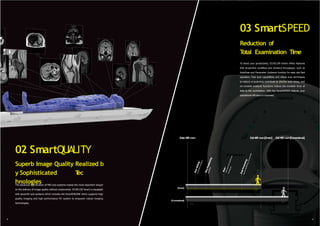 To boost your productivity, ECHELON Smart offers features
that streamline workflow and enhance throughput, such as
AutoPose and Parameter Guidance function for easy and fast
operation. Fast scan capabilities and robust scan techniques
to reduce re-scanning contribute to shorter scan times, and
on-console analysis functions reduce the transfer time of
data to the workstation. With the SmartSPEED feature, your
operational efficiency is improved.
Reduction of
T
otal Examination Time
03 SmartSPEED
02 SmartQUALITY
Superb Image Quality Realized b
y Sophisticated T
ec
hnologies
EnterMRI room ExitMRI room[Smart] ExitMRI room[Conventional]
Time
[Conventional]
5 6
[Smart]
The advanced specification of MRI sub-systems makes the most important impact
on the delivery of image quality without compromise. ECHELON Smart is equipped
with powerful sub-systems which includes the SmartENGINE which supports high
quality imaging and high performance RF system to empower robust imaging
technologies.
 