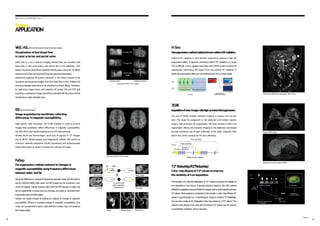 Using the difference in resonant frequencies betweenwater and fat protons
due to chemical shifts, both water and fat images can be acquired in one
round of imaging. FatSep acquires data when the MR signals of water and
fat are respectively in-phase and out-of-phase, and adds or subtracts them
togeneratewaterandfatimages.
FatSep can output images according to a degree of change in magnetic
susceptibility. If there is a greater change in magnetic susceptibility, Fine
mode can be selected to give a high-definition phase map and enhance
the image quality. FatSat FatSep Normal FatSep Fine
TIGRE principle diagram
H-sinc
Number of
Dummy segments
Phase encoding
The use of TIGRE enables dynamic imaging in organs such as the
liver. The large fat component in the abdomen and breast regions
require high-precision fat suppression. We have realized uniform fat
suppression effects and dynamic imaging in the abdomen and breast
through combined use of high uniformity of the static magnetic field
and H-Sinc which corrects for RF non-uniformity.
Slice encoding
Out of phase Water image
In phase Fat image
Principle of fat/
water separation
measurement
FatSep
Fat suppression method resistant tochanges in
magneticsusceptibilityusingfrequencydifferences
between water andfat
Wide-range, stable fat suppression with H-Sinc
Uniform RF radiation is one element required to achieve a high fat
suppression effect. In general, achieving uniform RF radiation in a large
FOV is difficult. H-Sinc applies more than one CHESS pulse to realize fat
suppression, minimizing the impact from non-uniform RF radiation. A
stable fatsuppression effect can be achieved even over a large range.
H-Sinc
H-Sinc method
Comparison of
remaining fat signals
Conventional
CHESS method
H-Sinc pulse part This sequence part
GC
RF
H-Sinc
Fatsuppressionmethodresistanttonon-uniformRFradiation
Breast TIGRE image
Abdominal dynamic image (TIGRE)
TIGRE
Acquisitionofclearimagesw
ithhigh-precisionfatsuppression
This function can map the distribution of T2* values to improve the visibility of
iron deposition in liver tissue. A special sequence based on the GRE method
(ADAGE)is availabletoacquireMultiEchoimagesusedtoautomaticallycalculate
T2*values.Whenanalysisis conductedontheconsole, a colormapofthese T2*
values is superimposed on a morphological image to create a T2*RelaxMap.
Youcan also create an R2 (Relaxation rate) map based on 1/T2*values. The
relative color display of an area with shortened T2*values can be used as
a quantitative evaluation of iron deposits.
T2*RelaxMap/R2*RelaxMap
†
Color mapdisplayof T2*values toimprove
the visibilityof iron deposition
Examples of BSI (minP) images
High-speed, high-resolution 3D T2*WI imaging is used to acquire
images that sensitively reflect differences in magnetic susceptibility.
Our BSI offers high-speed imaging due to EPI measurement.
Venous blood and hemorrhage cause loss of signals in T2* images
due to BOLD (blood-oxygen level dependent) effects. BSI performs
minimum intensity projection (minIP) processing and superimposes
phase information to further increase the contrast of images.
Image acquisitionby sensitively reflecting
differences inmagnetic susceptibility
BSI(BloodSensitiveImaging)
†
VASC-ASL is a non-contrast imaging method that can visualize fast
blood flow in the renal artery and portal vein in the abdomen. This
feature visualizes blood flows labelled with IR pulses using the 3D BASG
sequence and does not require ECG/pulse wave synchronization.
Selectively applying IR pulses upstream in the blood vessels to be
visualized and acquiring images when the blood flow is Null enables the
incoming labelled blood flow to be visualized as Black Blood. Therefore,
by capturing images twice with selective IR pulses ON and OFF and
acquiring a subtraction image, blood flows labelled with IR pulses will be
visualized as a high-intensity area.
(a) Portal veins (b) Renal arteries
Examples of VASC-ASL images
IR pulse OFF
IR pulse ON
Subtraction
image
V
ASC-ASL(V
einsandArteries SansContrast-Arterial SpinLabeling)
Visualization of fast blood flow
inrenal arteries and portal veins
Appl i c a ti on/ E CHEL ON S ma r t
Fat Water
T2* RelaxMap
RF
Echo
Anatomical image
Signal
strength
Anatomical +
T2* value image
T2* coefficient
MultiEcho sequence and Echo count
T2* attenuation
Smart
† Optional
1
3 1
4
APPLICA
TION
 