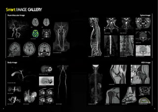 3D-TOF MRA (MIP)
isoFSE-MPR (SAG)
isoFSE-FLAIR (VR)
3D-isoFSE MRCP (MIP)
isoFSE-MPR (COR)
3D-TOF WideMRA (MIP)
VASC-ASL (VR)
RADAR-FatSat T2WI (RG)
Body-DWI (Reverse)
VASC-ASL (MIP)
VASC-ASL (MIP) BASG-Cine VASC-FSE (MIP)
Body-image
WholeSpine-T2WI
WholeBody-DWI (MIP)
3D-BASG (MIP)
FatSep-T2WI (In)
3D-RSSG-MPR (Obl)
FatSep-T2WI (Sub)
ADAGE-T2*WI
HighRes-T2WI
HighRes-T2WI (Reverse)
Spine-image
FatSat PDWI HighRes-T2WI
ADAGE-T2*WI
T2 RelaxMap (ColorMap)
HighRes-PDWI ADAGE-T2*WI
MSK-image
NueroVascular-Image
ASL-Perfusion
DWI
BPAS
BSI
Sm
artIMAGE GALLERY
1
5 1
6
 