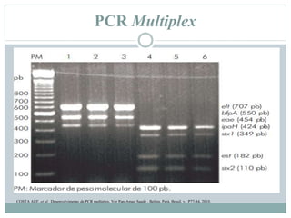 PCR Multiplex
COSTA ARF, et al. Desenvolvimento de PCR multiplex, Ver Pan-Amaz Saude , Belém, Pará, Brasil, v. P77-84, 2010.
 