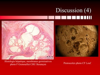 Discussion (4)




Histologie hépatique, membranes germinatives
     photo F Grenouillet CHU Besançon             Protoscolex photo CF Louf
 