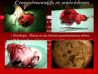 Commémoratifs et antécédents
                      pathologiques
• Février 2006, lobectomie hépatique
     • Echinococcose Alvéolaire (diagnostic invasif histologique
       confirmé par PCR mais partiellement curatif)
     • Histologie : fibrose et une réaction granulomateuse inflam.
     • PCR spécifique d’Echinococcus multilocularis réalisée sur la
       lésion (bloc d’inclusion en paraffine) confirme le diagnostic
       d’Echinococcose alvéolaire.
     • Dépistage sérologique et échographique - des propriétaires
     • Depuis : Hill’s® LD, param. hépatiques stable et Milbémax®
       4x/an et vaccins réguliers
• Chirurgie du ligament croisé antérieur G en 09/2011
 