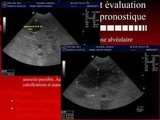 Diagnostic et évaluation
                                   pronostique

• Suspicion de récidive d’Echinococcose alvéolaire
      • Antécédents, clinique et images échographiques.
• Etude de 11 cas
      • augmentation progressive de volume de l’abdomen antérieur
        asymptomatique est le signe constamment rapporté,
      • 9/11 masse hépatique cavitaire, parenchyme hétérogène et kystique lésion
        associée possible. Aucune vascularisation (Doppler couleur). Présence de
        calcifications et aspect granulomateux en orage de grêle manque ici
• Pronostic
   • Humains sans traitement, mortalité 80%
   • Médiane de survie 3 ans chez 7 chiens opérés puis traités par
     albendazole et durée de vie la plus longue 8 ans.
 