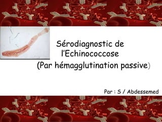 S/A
RSérodiagnostic de
l’Echinococcose
(Par hémagglutination passive)
Par : S / Abdessemed
 