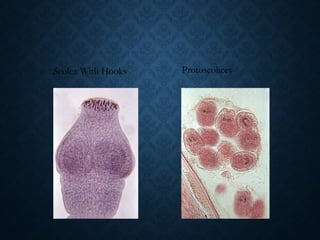 Scolex With Hooks Protoscolices
 