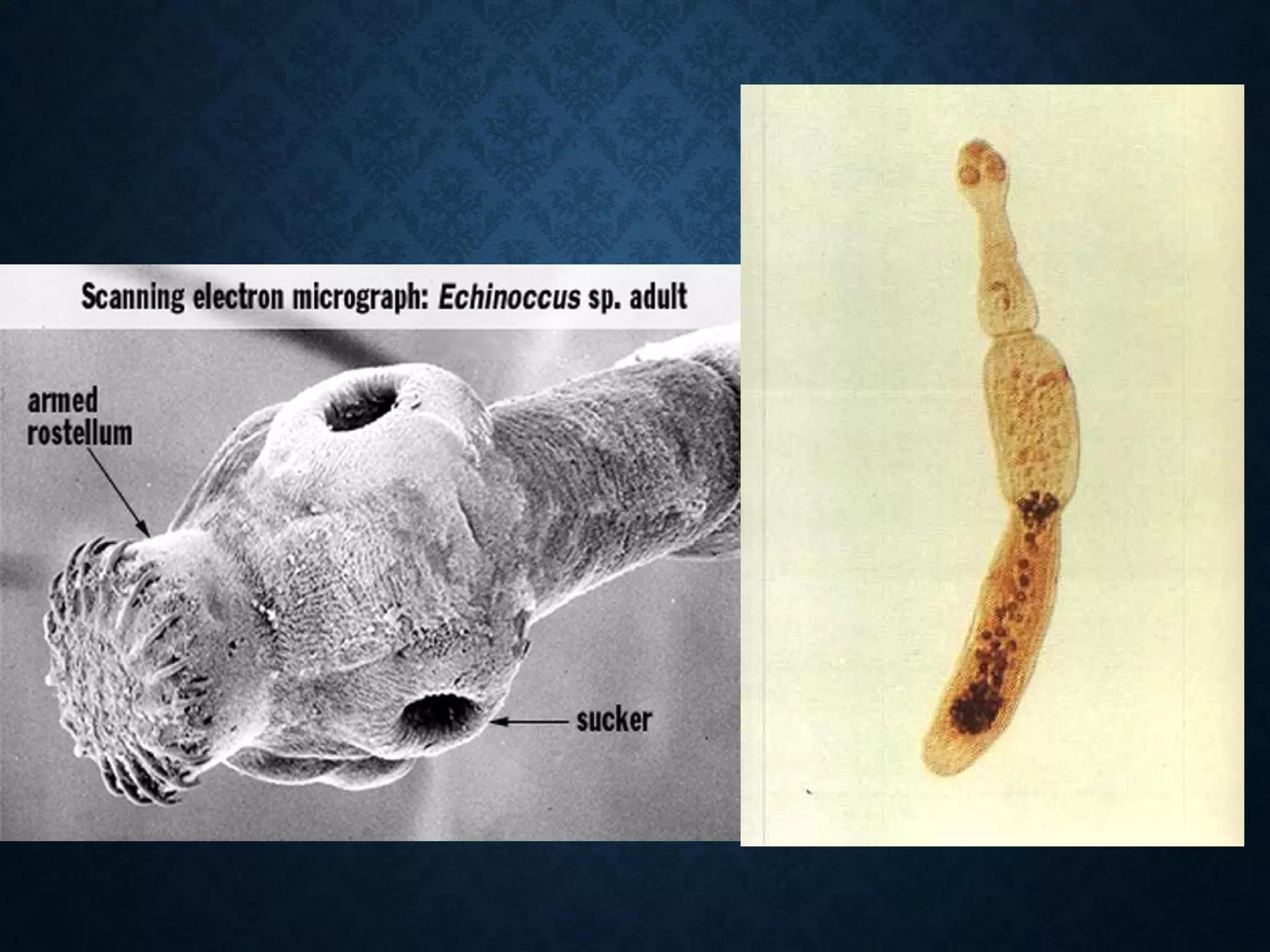 Echinococcus | PPT