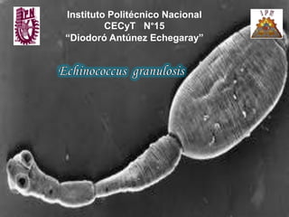 Instituto Politécnico Nacional
         CECyT N°15
“Diodoró Antúnez Echegaray”
 