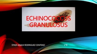 ECHINOCOCCUS
GRANULOSUS
SYNDI ANAHI RODRIGUEZ CENTENO 2°B
 