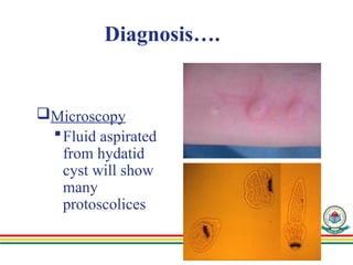 Echinococcus slideshare Presentation (1).pptx