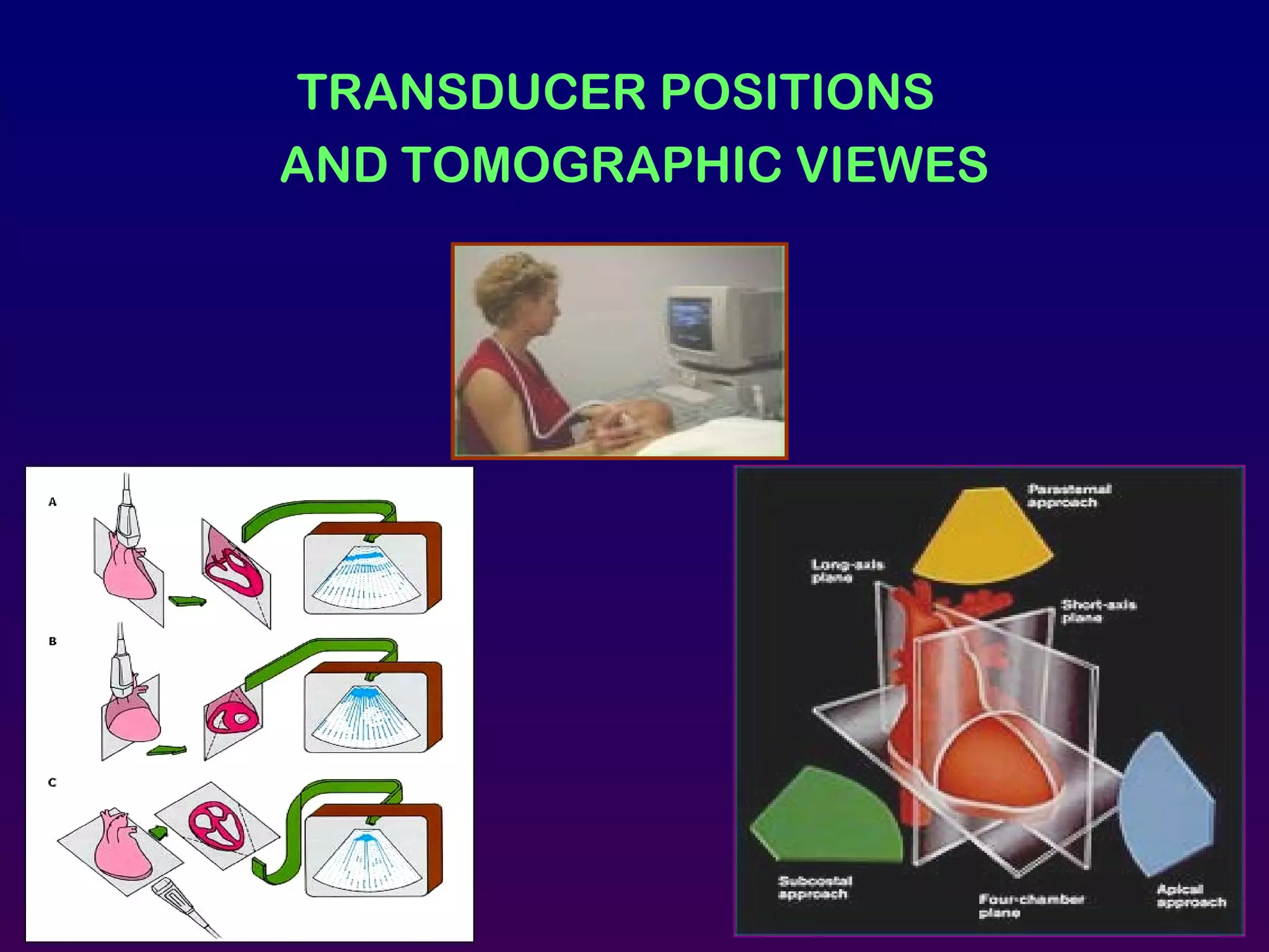TRANSDUCER POSITIONS
AND TOMOGRAPHIC VIEWES
 