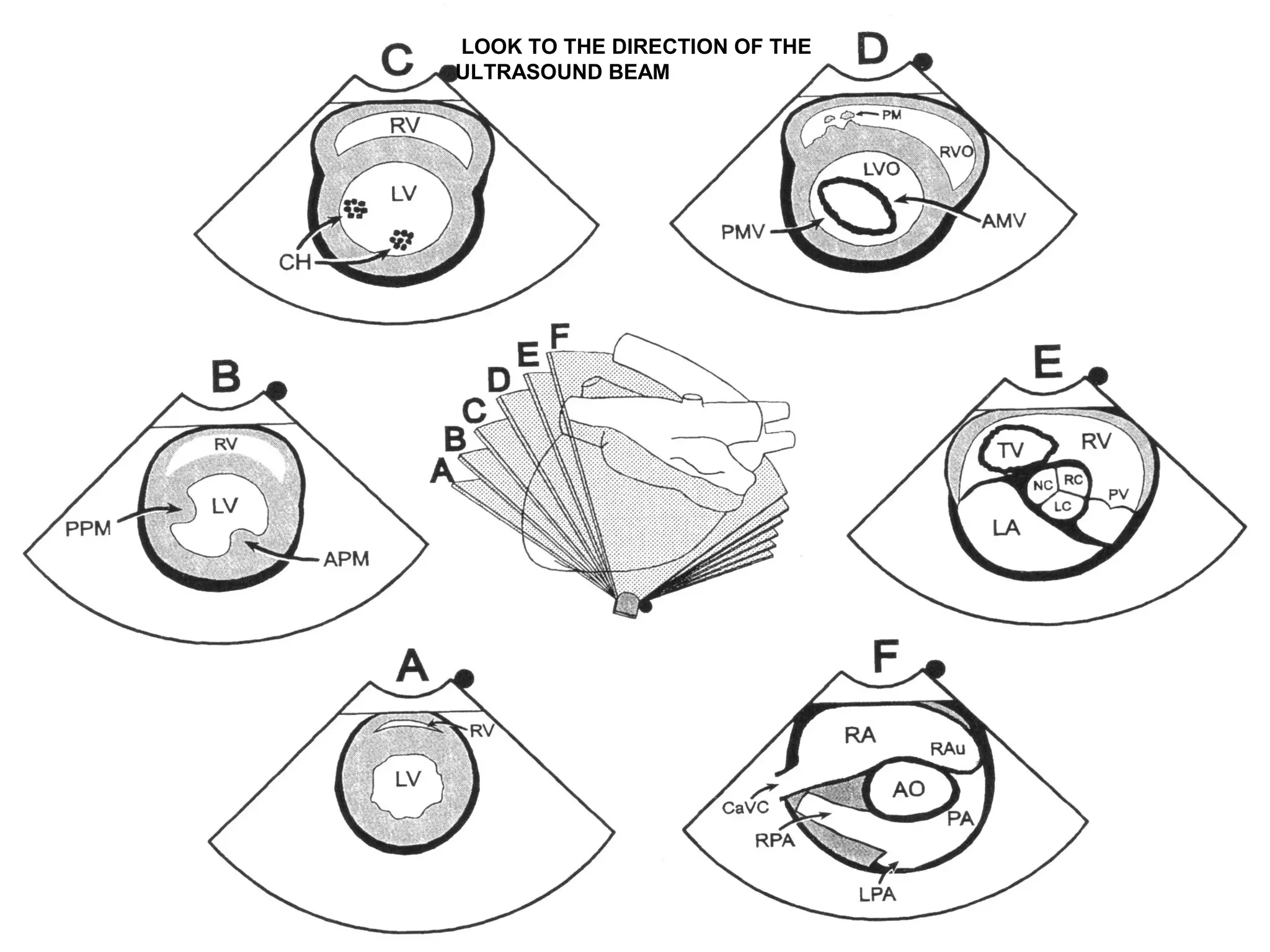 LOOK TO THE DIRECTION OF THE
ULTRASOUND BEAM
 