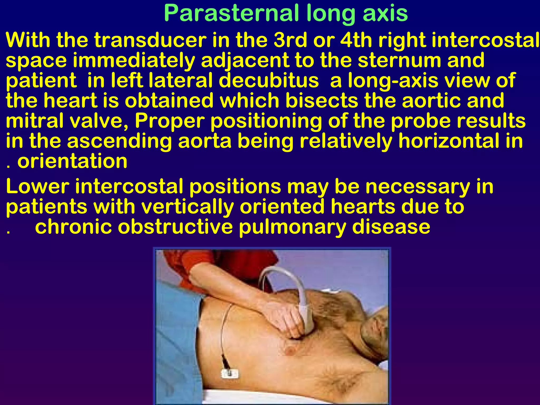 Parasternal long axis
With the transducer in the 3rd or 4th right intercostal
space immediately adjacent to the sternum and
patient in left lateral decubitus a long-axis view of
the heart is obtained which bisects the aortic and
mitral valve, Proper positioning of the probe results
in the ascending aorta being relatively horizontal in
orientation.
Lower intercostal positions may be necessary in
patients with vertically oriented hearts due to
chronic obstructive pulmonary disease.
 