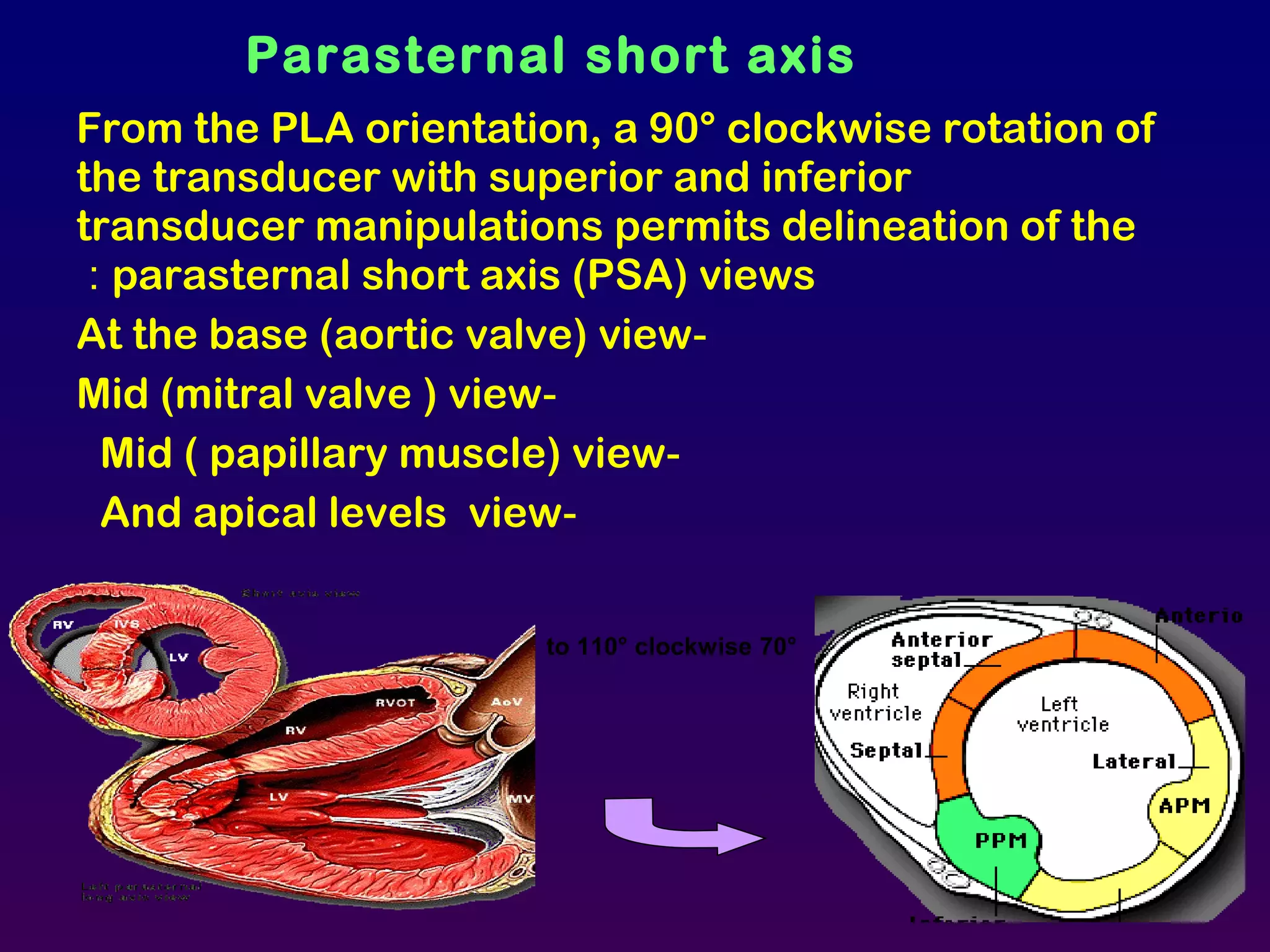 From the PLA orientation, a 90° clockwise rotation of
the transducer with superior and inferior
transducer manipulations permits delineation of the
parasternal short axis (PSA) views:
-At the base (aortic valve) view
-Mid (mitral valve ) view
-Mid ( papillary muscle) view
-And apical levels view
Parasternal short axis
70°to 110° clockwise
 