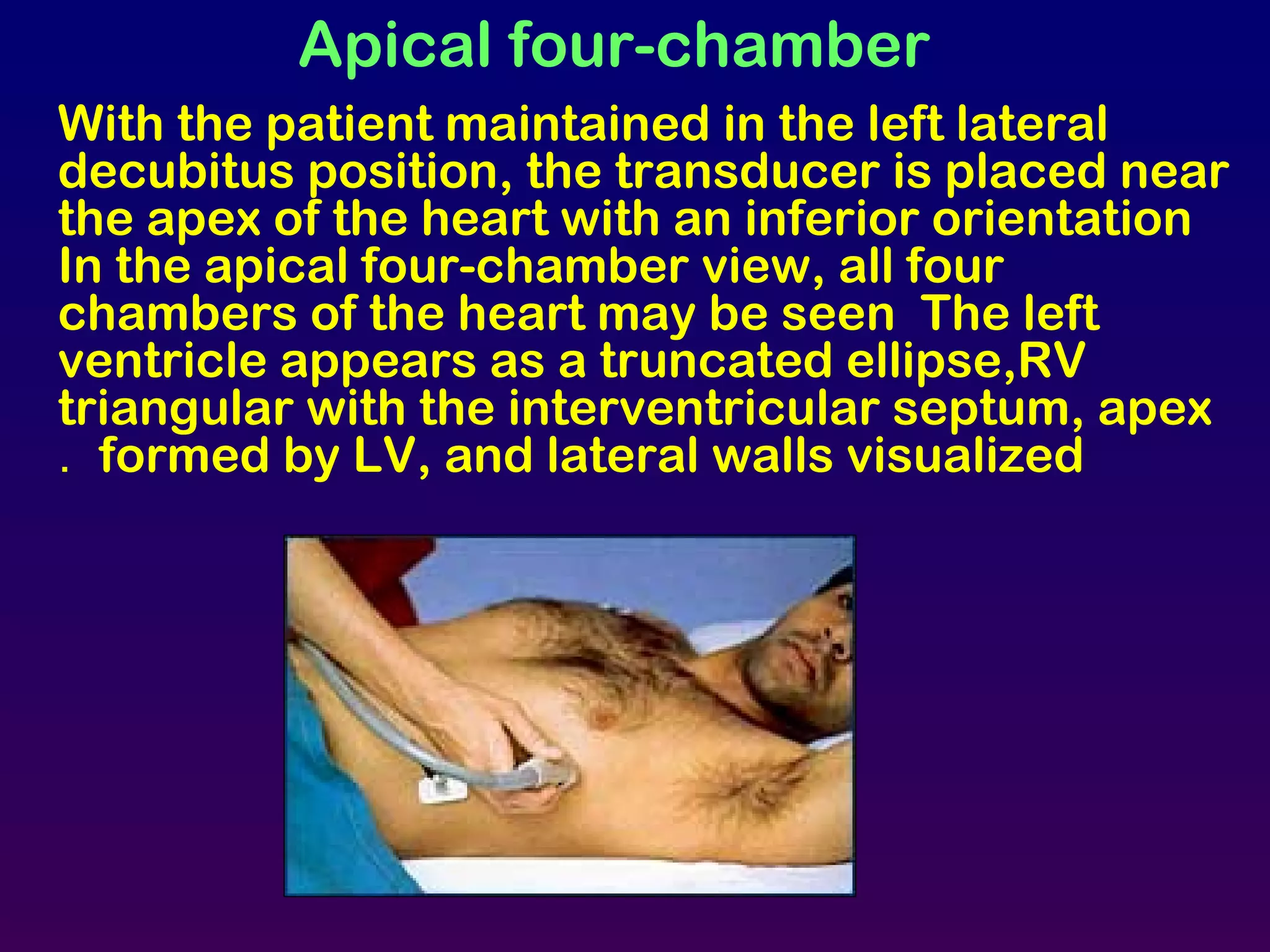With the patient maintained in the left lateral
decubitus position, the transducer is placed near
the apex of the heart with an inferior orientation
In the apical four-chamber view, all four
chambers of the heart may be seen The left
ventricle appears as a truncated ellipse,RV
triangular with the interventricular septum, apex
formed by LV, and lateral walls visualized.
Apical four-chamber
 