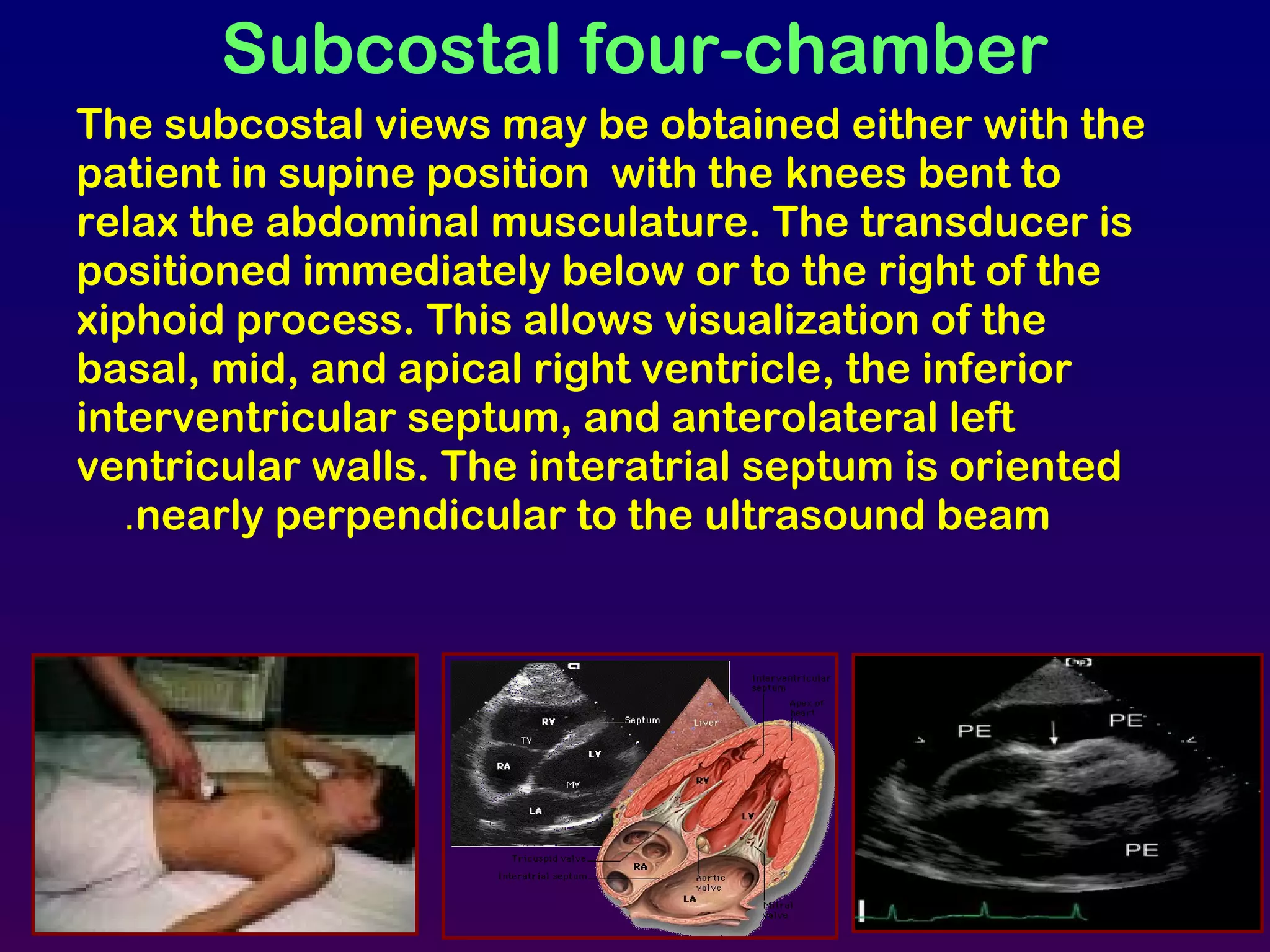 Subcostal four-chamber
The subcostal views may be obtained either with the
patient in supine position with the knees bent to
relax the abdominal musculature. The transducer is
positioned immediately below or to the right of the
xiphoid process. This allows visualization of the
basal, mid, and apical right ventricle, the inferior
interventricular septum, and anterolateral left
ventricular walls. The interatrial septum is oriented
nearly perpendicular to the ultrasound beam.
 