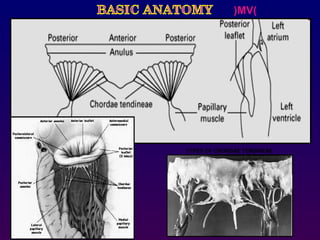 )MV(
TYPES OF CHORDAE TENDINEAE
 