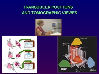 TRANSDUCER POSITIONS
AND TOMOGRAPHIC VIEWES
 