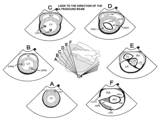 LOOK TO THE DIRECTION OF THE
ULTRASOUND BEAM
 