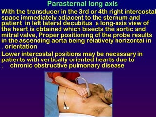 Parasternal long axis
With the transducer in the 3rd or 4th right intercostal
space immediately adjacent to the sternum and
patient in left lateral decubitus a long-axis view of
the heart is obtained which bisects the aortic and
mitral valve, Proper positioning of the probe results
in the ascending aorta being relatively horizontal in
orientation.
Lower intercostal positions may be necessary in
patients with vertically oriented hearts due to
chronic obstructive pulmonary disease.
 
