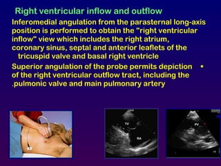Right ventricular inflow and outflow
Inferomedial angulation from the parasternal long-axis
position is performed to obtain the "right ventricular
inflow" view which includes the right atrium,
coronary sinus, septal and anterior leaflets of the
tricuspid valve and basal right ventricle
•Superior angulation of the probe permits depiction
of the right ventricular outflow tract, including the
pulmonic valve and main pulmonary artery.
PVTV
RA
 