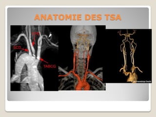 echo-anatomie-vasculaire2015-33.pdf