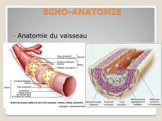 echo-anatomie-vasculaire2015-33.pdf