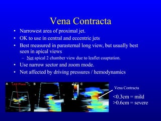 Vena Contracta Narrowest area of proximal jet. OK to use in central and eccentric jets Best measured in parasternal long view, but usually best seen in apical views  Not  apical 2 chamber view due to leaflet coaptation. Use narrow sector and zoom mode. Not affected by driving pressures / hemodynamics Vena Contracta <0.3cm = mild >0.6cm = severe 