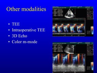 Other modalities TEE Intraoperative TEE 3D Echo Color m-mode 