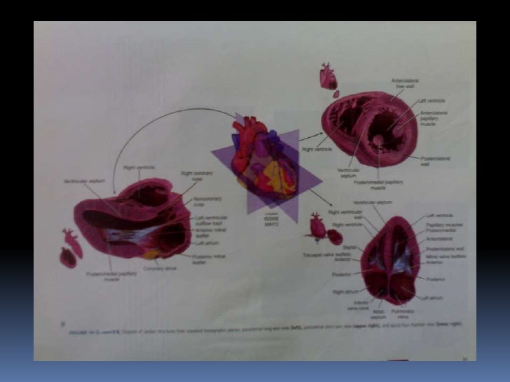 heart 2d echo test Basics Echocardiogram heart 2d echo test Basics Echocardiogram