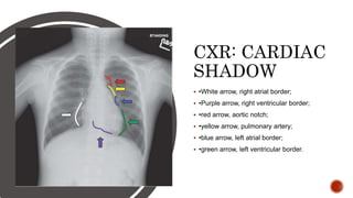 echocardiographic approach to congenital heart disease | PPTX