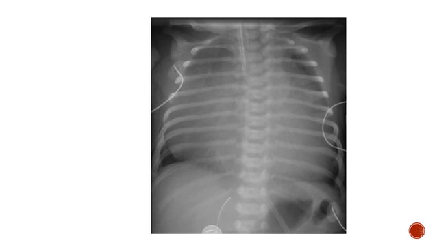 ECHOCARDIOGRAPHY IN PEDIATRIC AND CONGENITAL HEART DISEASE PDF DOWNLOAD visual data 6