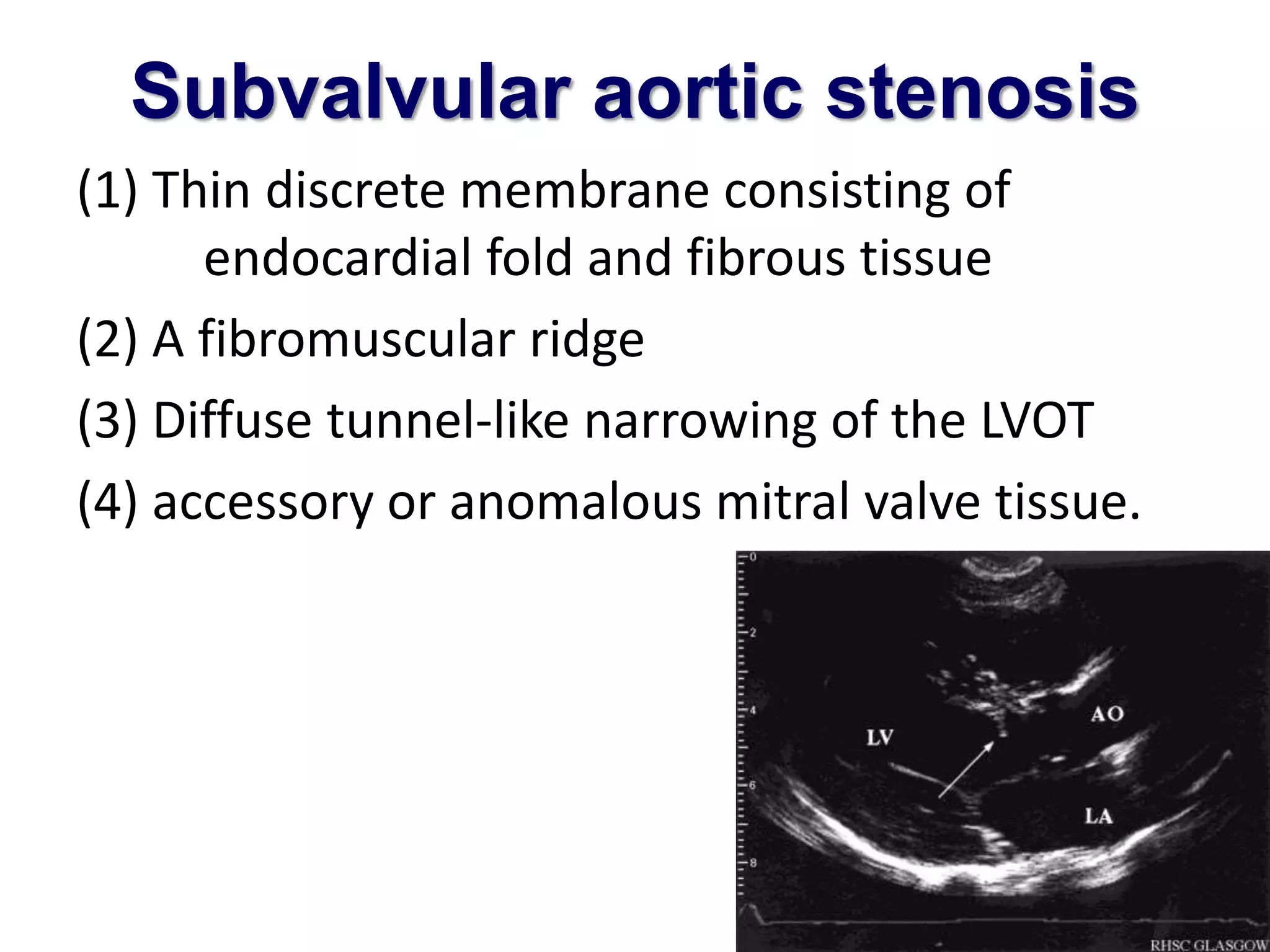 Subvalvular aortic stenosis 
(1) Thin discrete membrane consisting of 
endocardial fold and fibrous tissue 
(2) A fibromuscular ridge 
(3) Diffuse tunnel-like narrowing of the LVOT 
(4) accessory or anomalous mitral valve tissue. 
 
