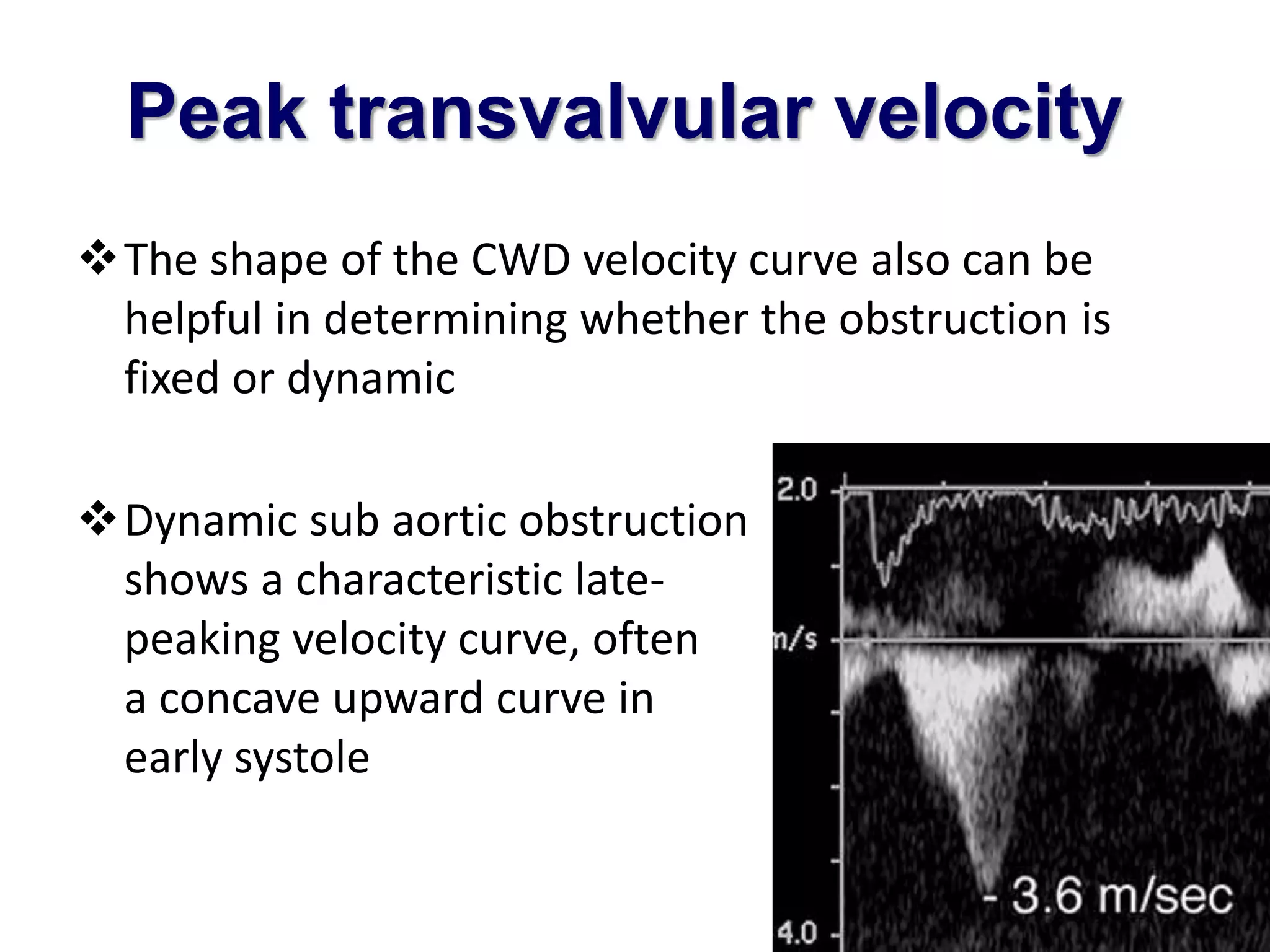 Peak transvalvular velocity 
The shape of the CWD velocity curve also can be 
helpful in determining whether the obstruction is 
fixed or dynamic 
Dynamic sub aortic obstruction 
shows a characteristic late-peaking 
velocity curve, often with 
a concave upward curve in 
early systole 
 
